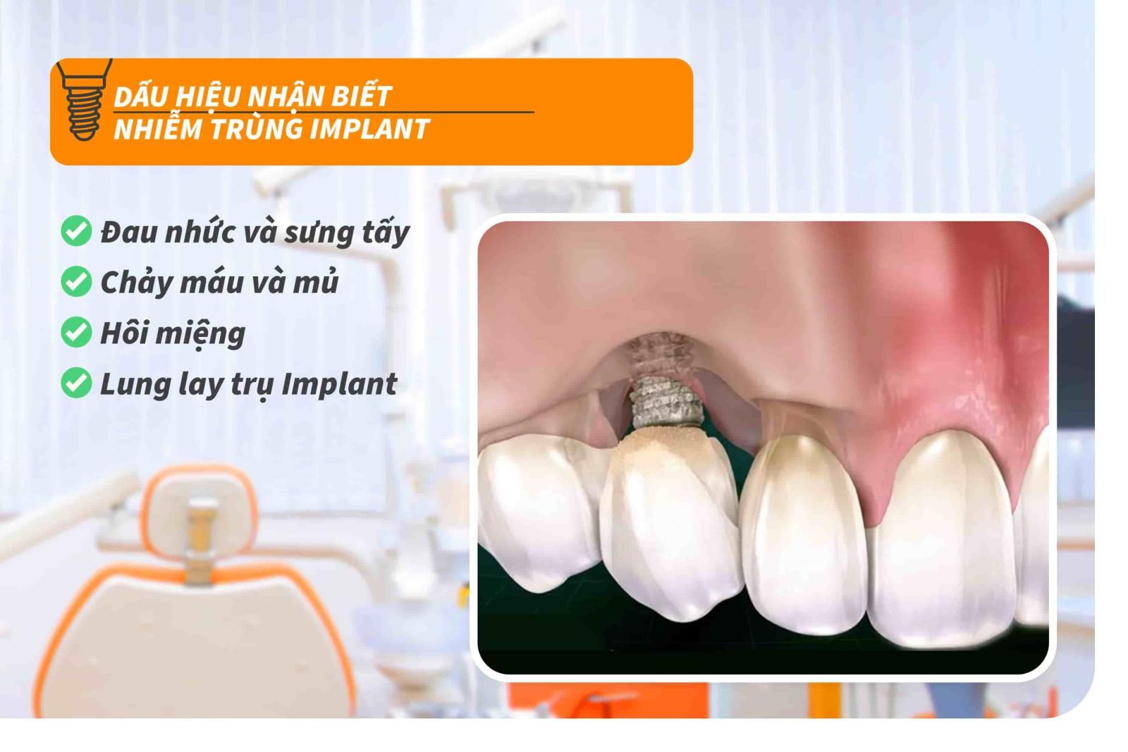 Dấu hiệu nhận biết nhiễm trùng Implant