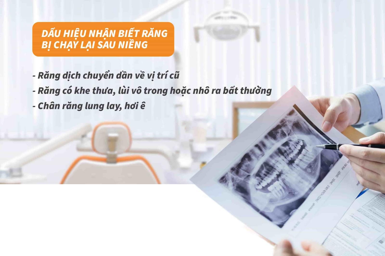 Dấu hiệu nhận biết răng bị chạy lại sau niềng 