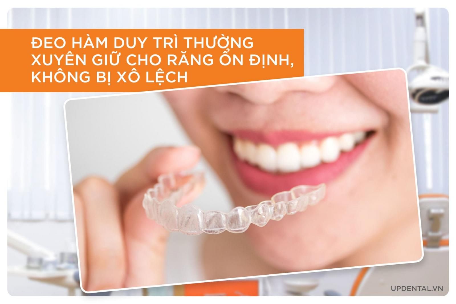 tại sao cần phải đeo hàm duy trì sau niềng 