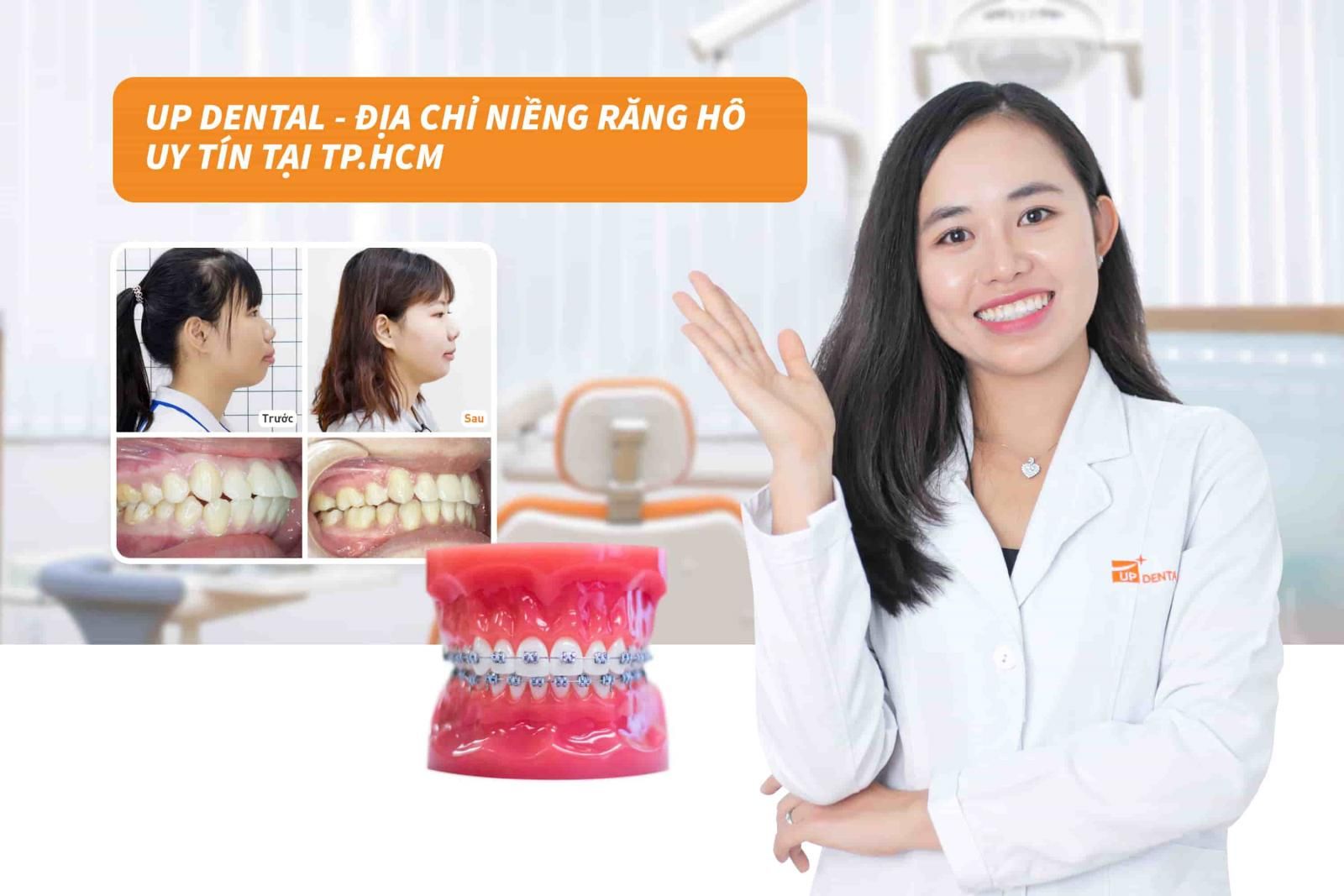 Địa chỉ chữa răng hô nhẹ uy tín tại TP.HCM