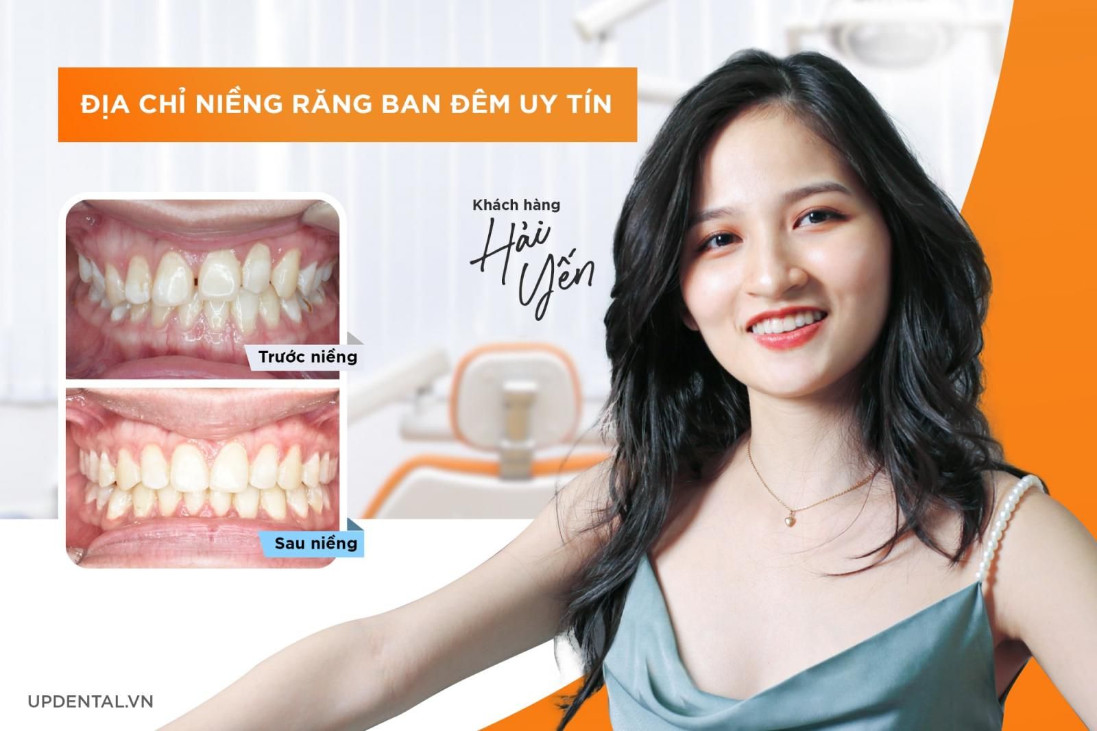 Địa chỉ niềng răng uy tín