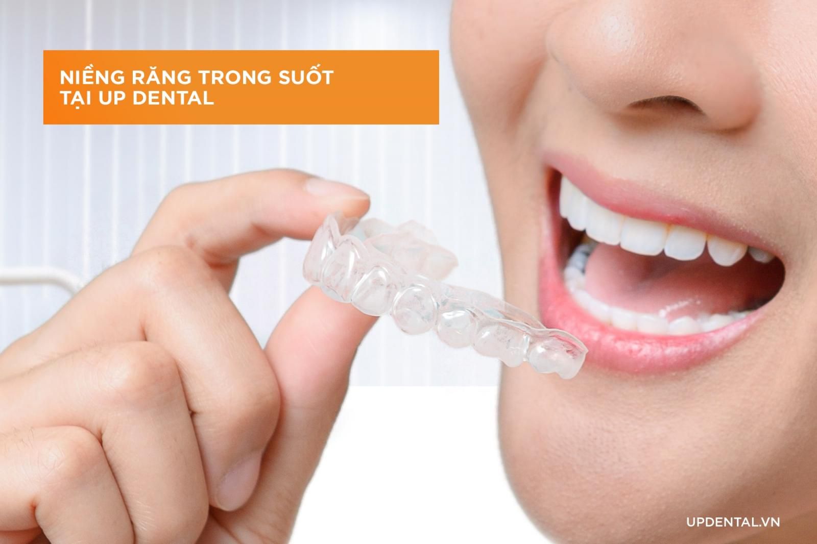 Địa chỉ niềng răng trong suốt tại Up Dental