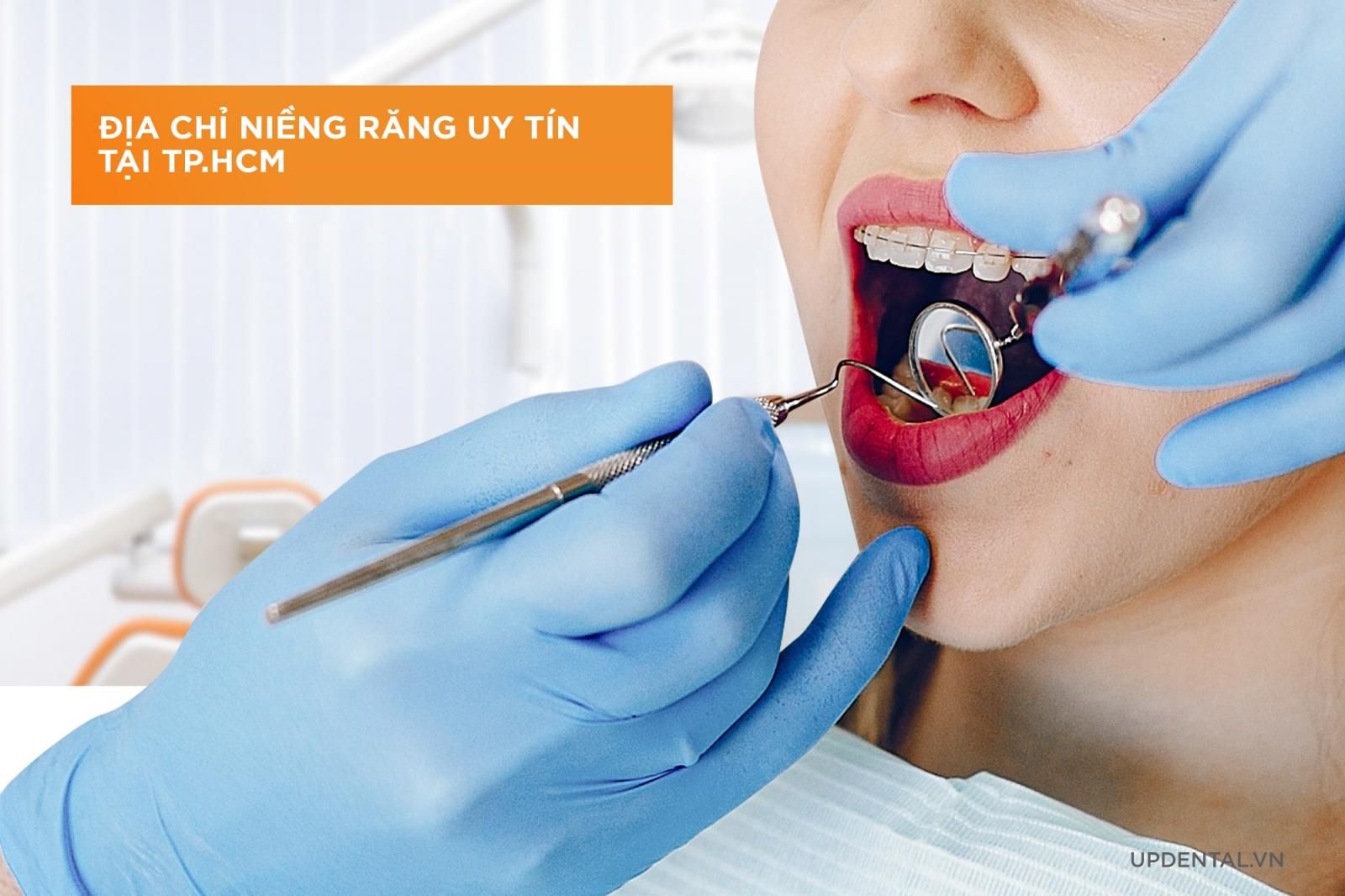 Địa chỉ niềng răng uy tín tại tphcm