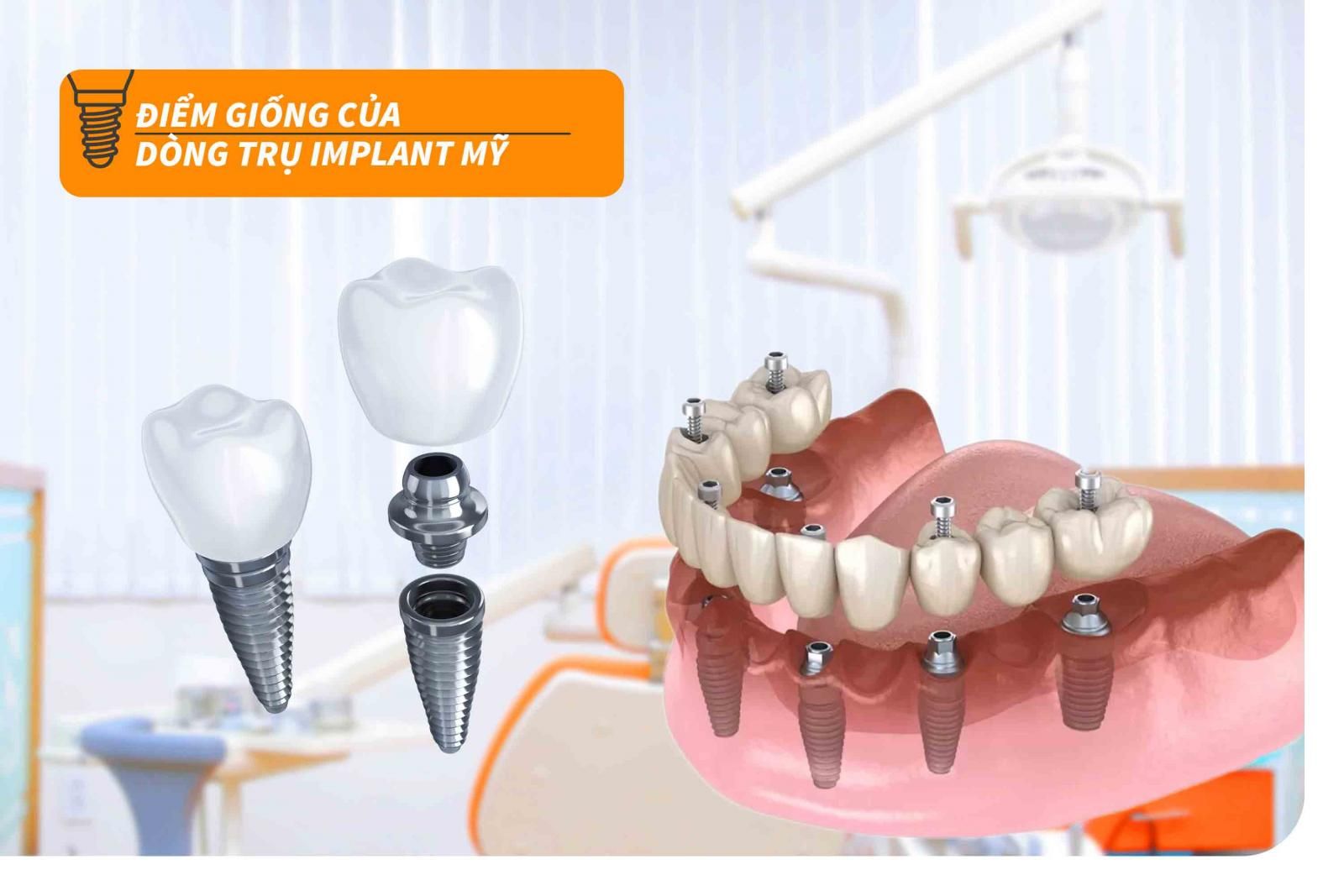 Đặc điểm chung của các dòng trụ Implant Mỹ