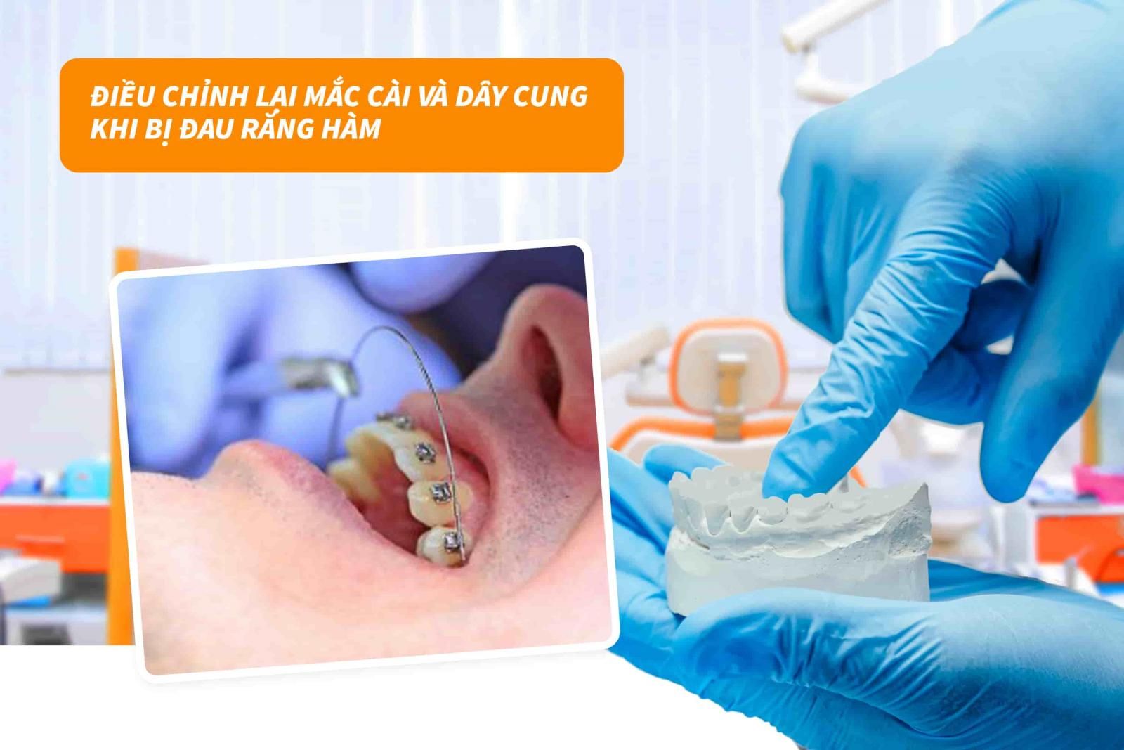 Điều chỉnh lại mắc cài và dây cung 