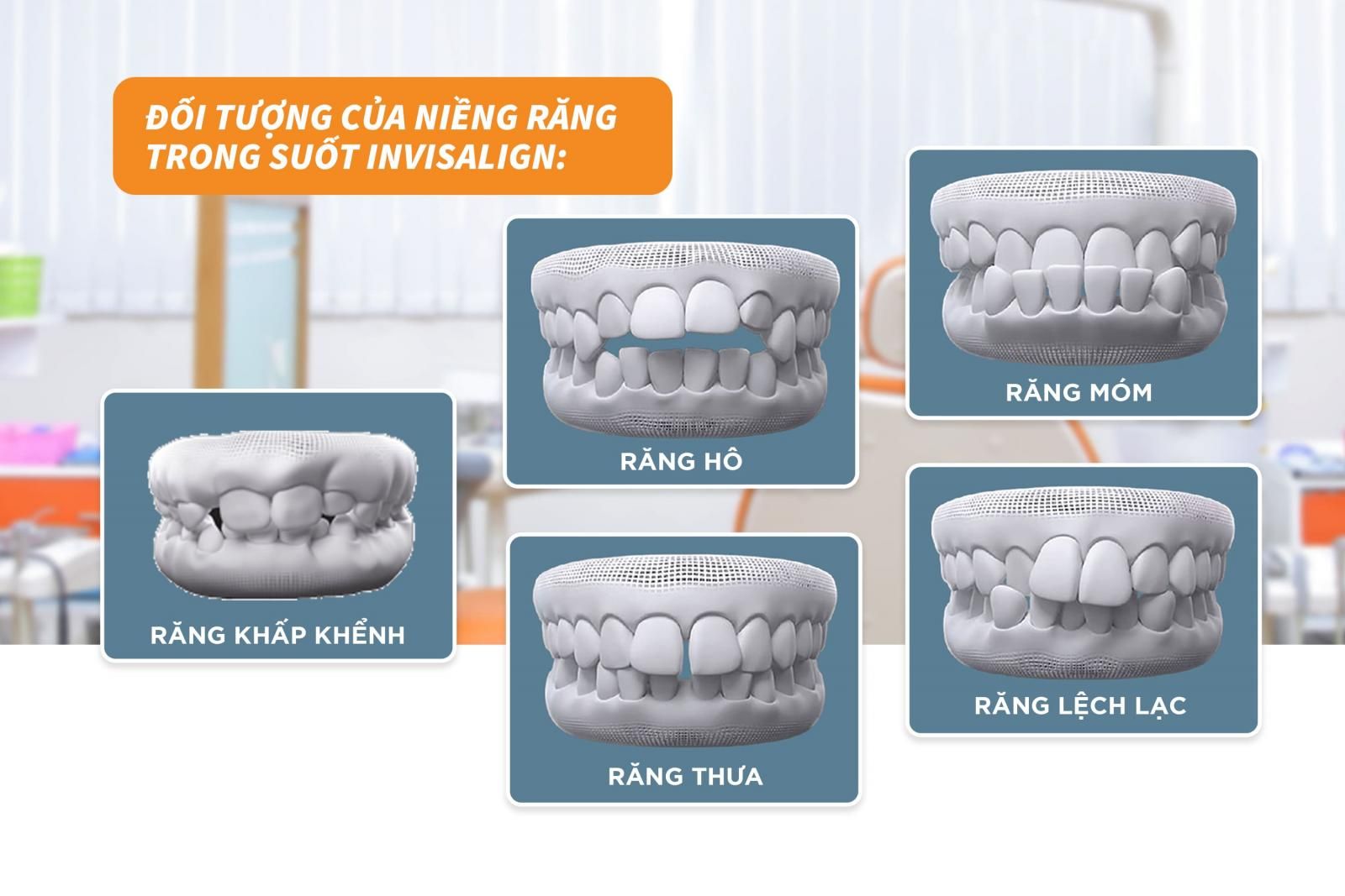 Đối tượng của niềng răng Invisalign