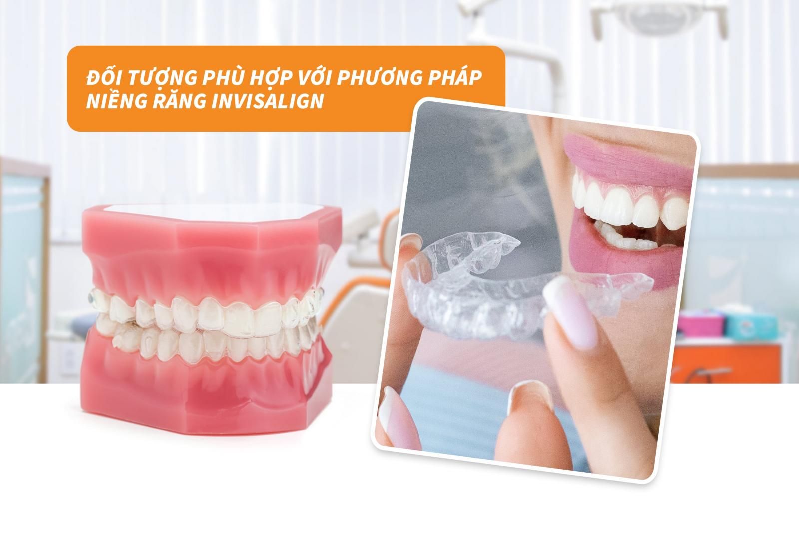 Đối tượng phù hợp với phương pháp niềng răng Invisalign