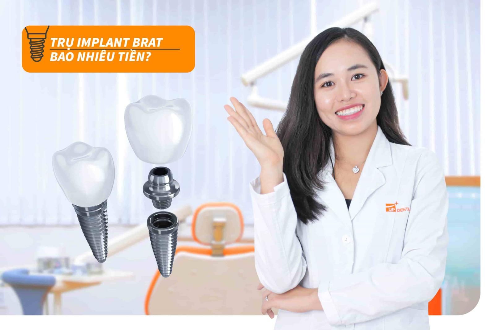 Giá của trụ Implant Brat hiện nay