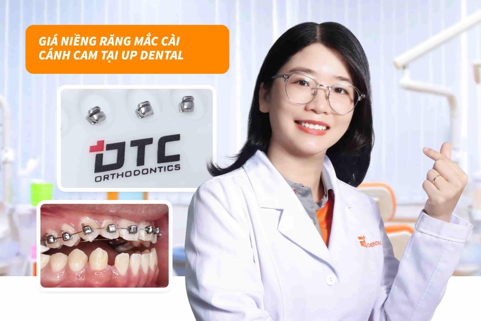 Giá niềng răng mắc cài cánh cam tại Up Dental