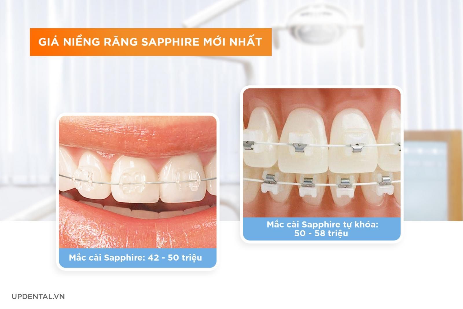 Giá niềng răng sapphire