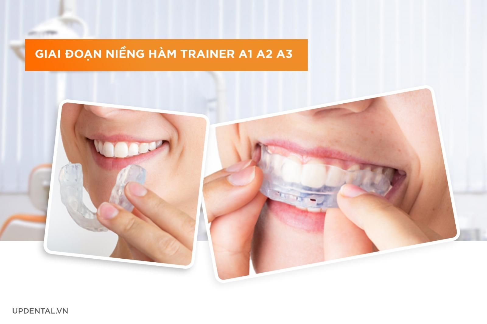 giai đoạn niềng răng hàm trainer A1 A2 A3