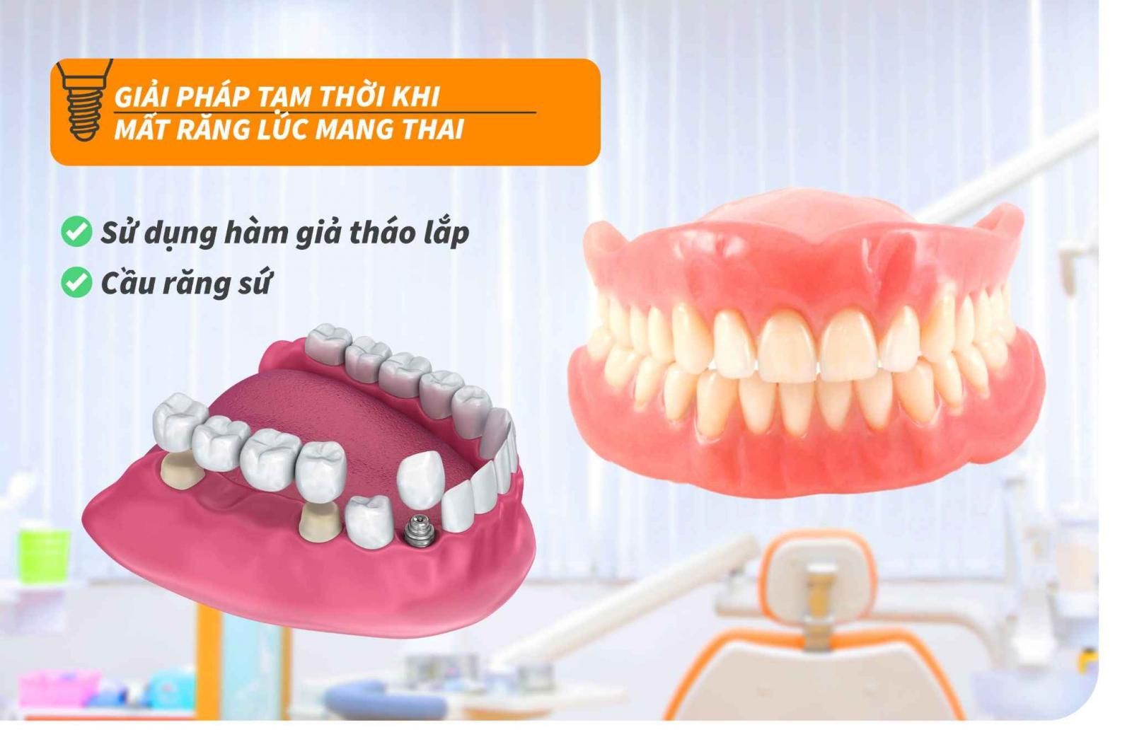 Giải pháp tạm thời khi mất răng lúc mang thai