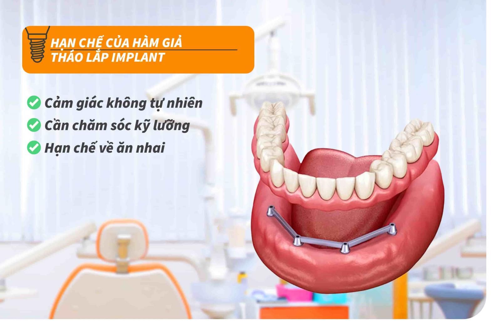 Hạn chế của hàm giả tháo lắp Implant