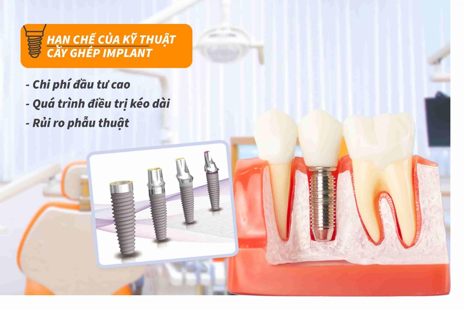 Hạn chế của kỹ thuật cấy ghép Implant