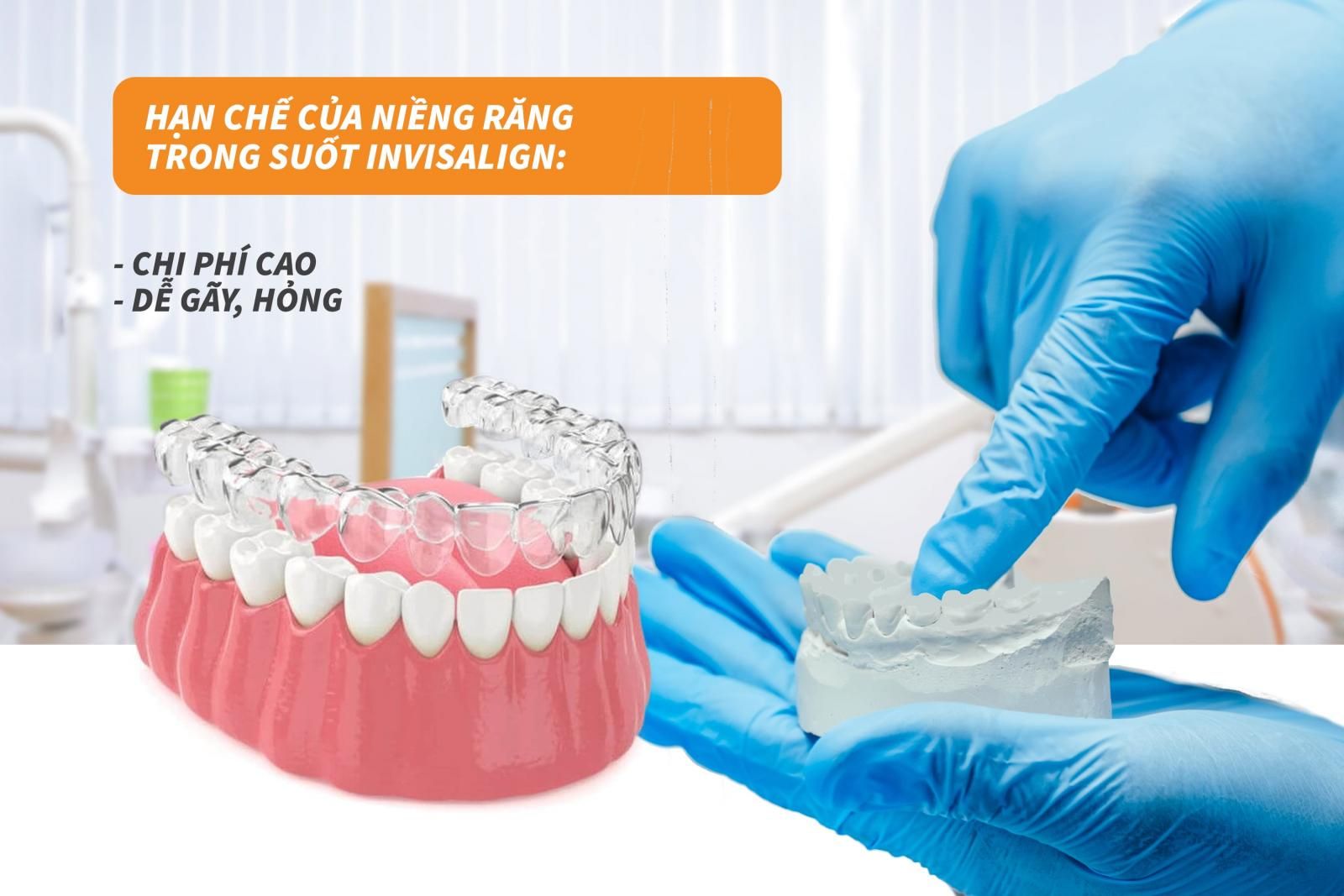 Hạn chế của niềng răng Invisalign