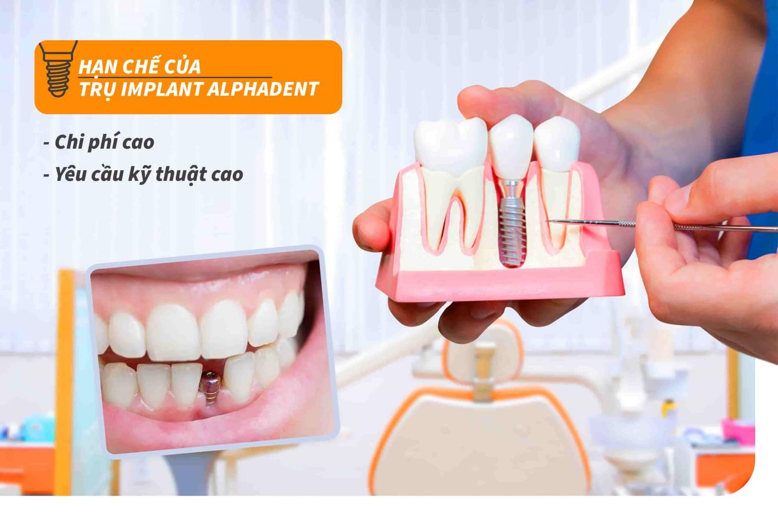 Hạn chế của trụ Implant Alphadent