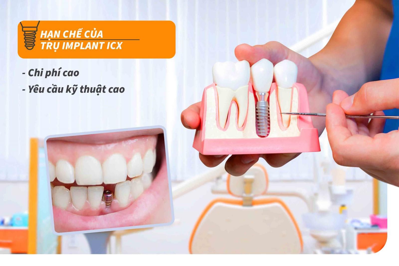 Hạn chế của trụ Implant ICX