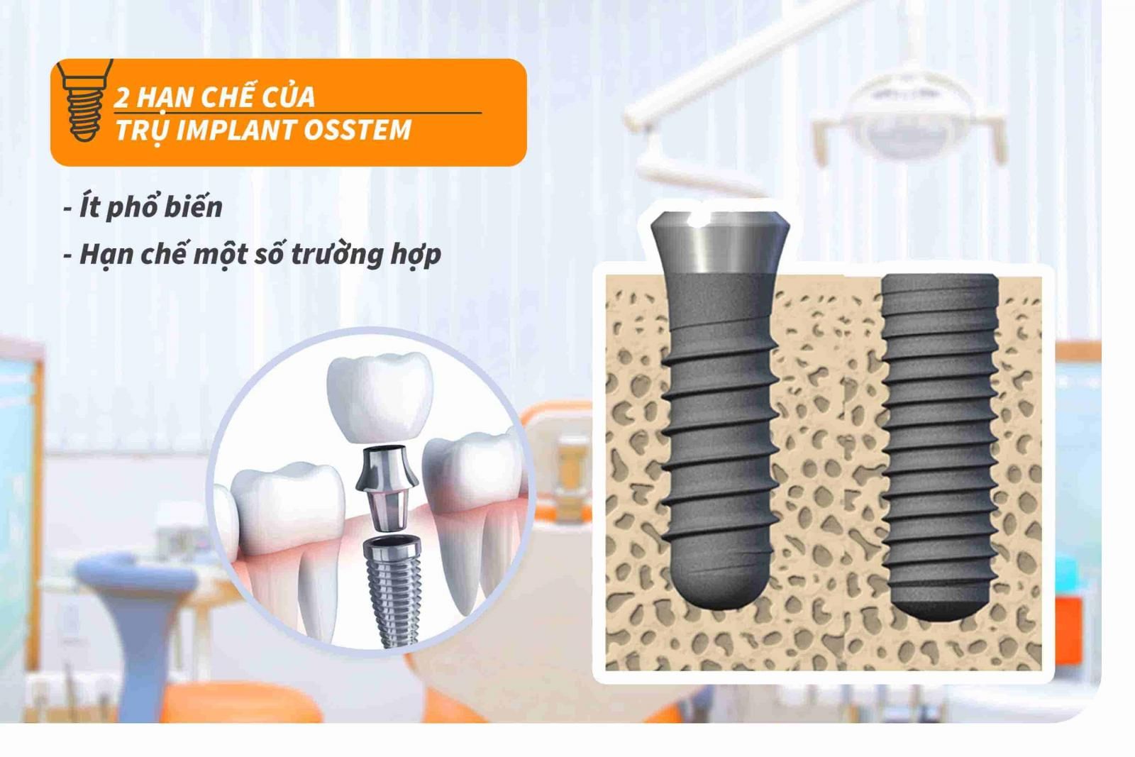 2 hạn chế của trụ Implant Osstem