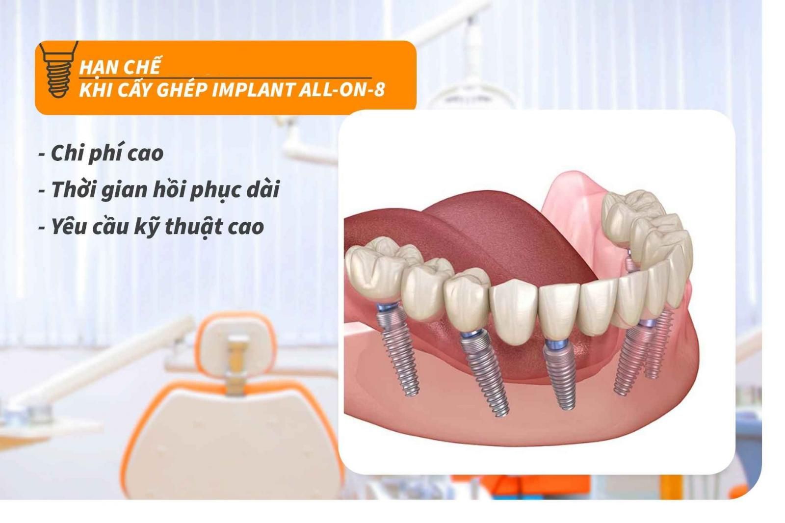 Hạn chế khi cấy ghép Implant All-on-8