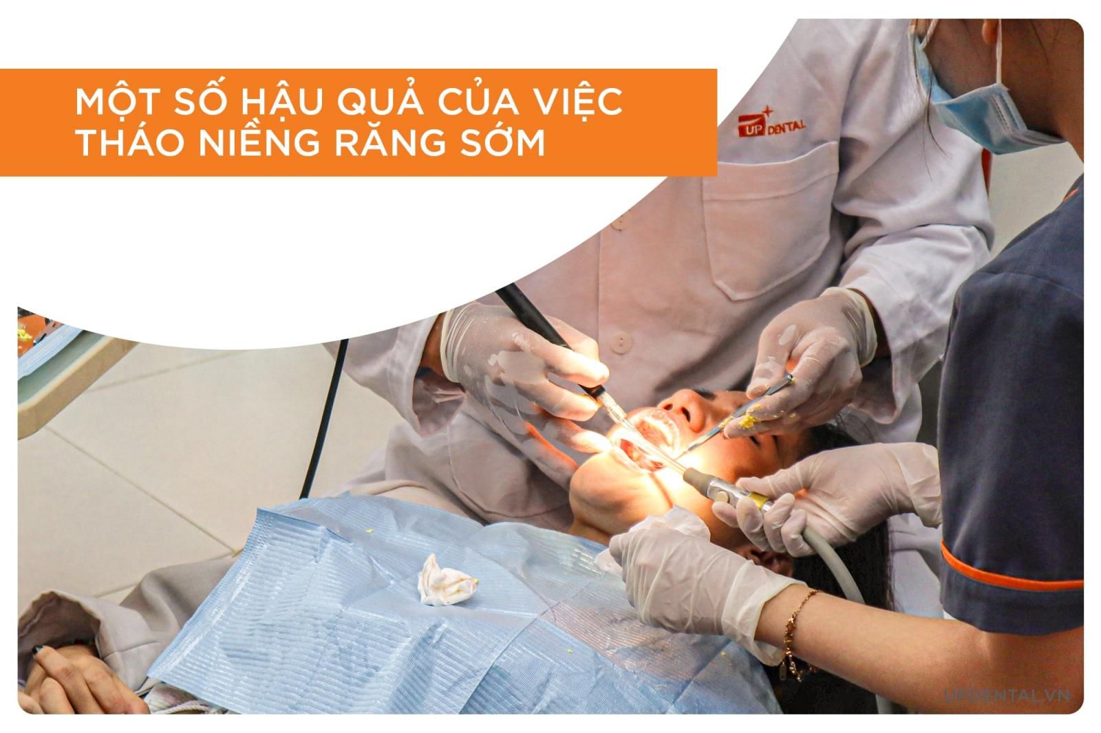 hậu quả khi niềng răng sớm