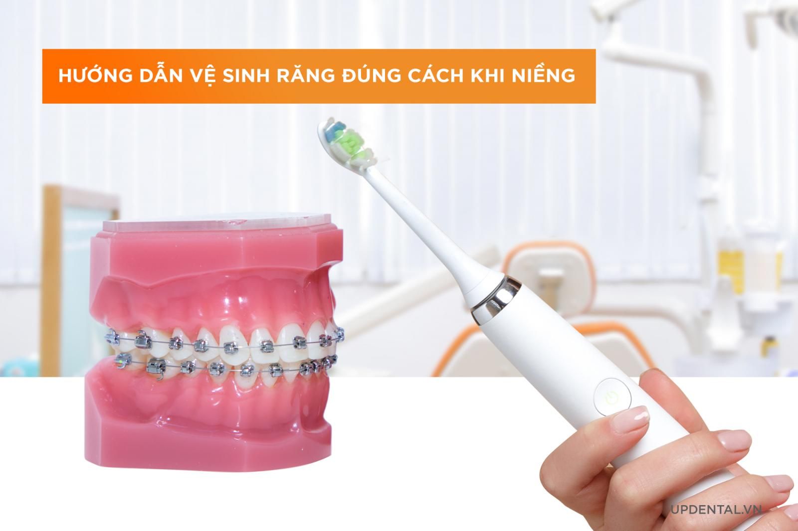 Hướng dẫn vệ sinh đúng cách khi niềng