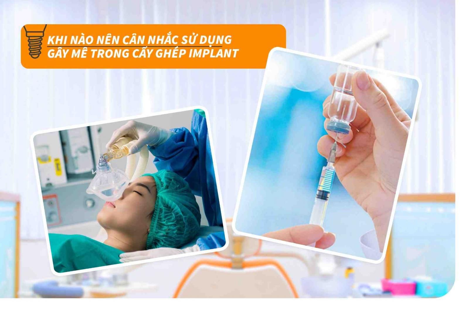 Khi nào nên cân nhắc sử dụng gây mê trong cấy ghép Implant?