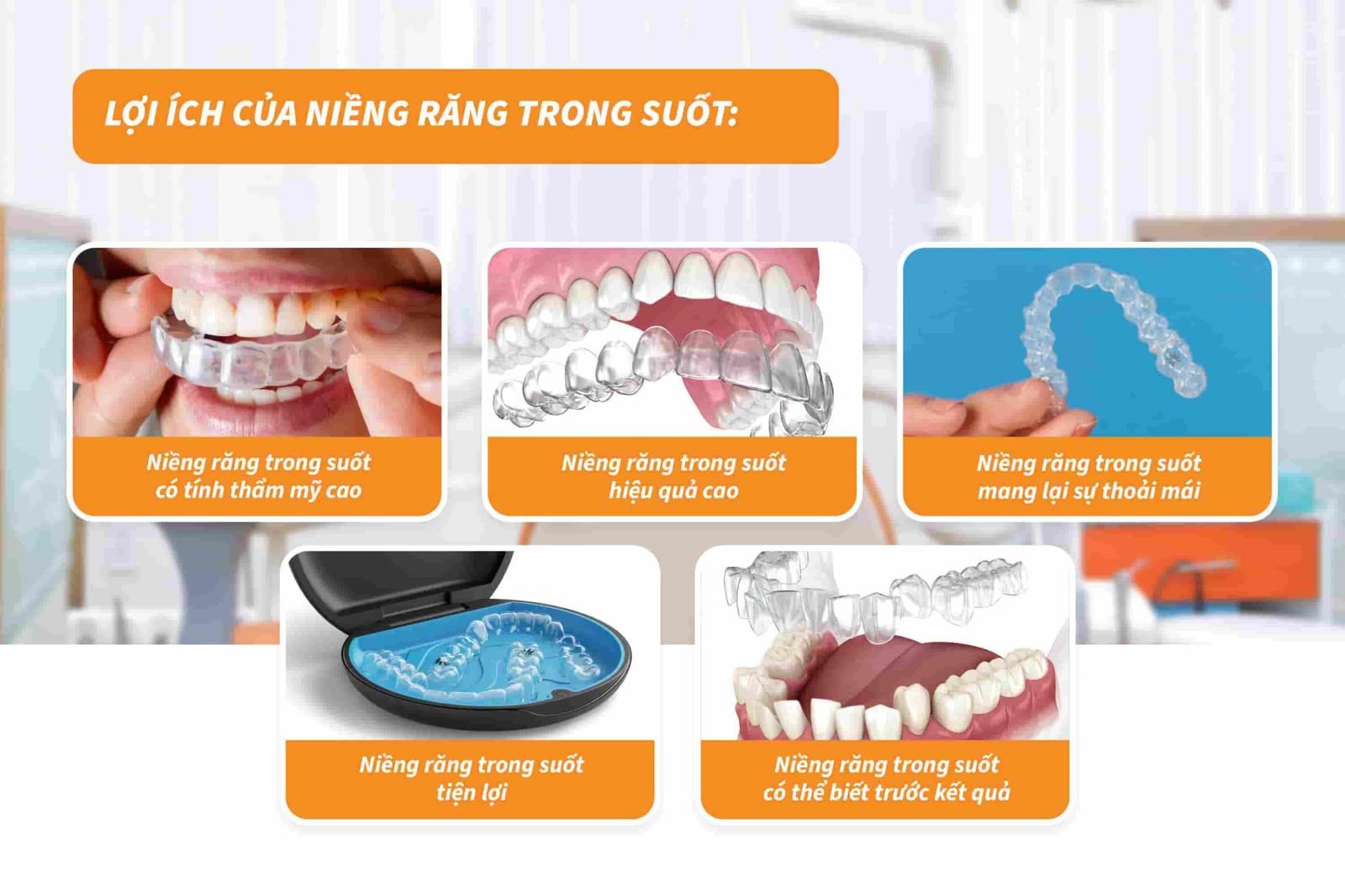 Lợi ích của niềng răng trong suốt