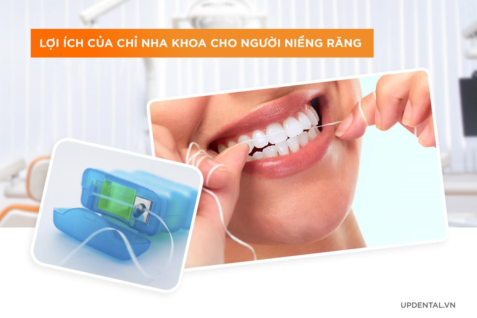 Lợi ích của dùng chỉ nha khoa cho người niềng răng