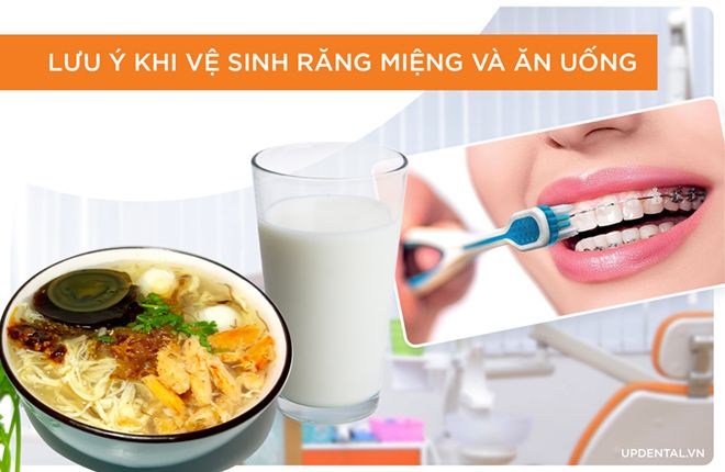 Lưu ý khi vệ sinh răng miệng và ăn uống