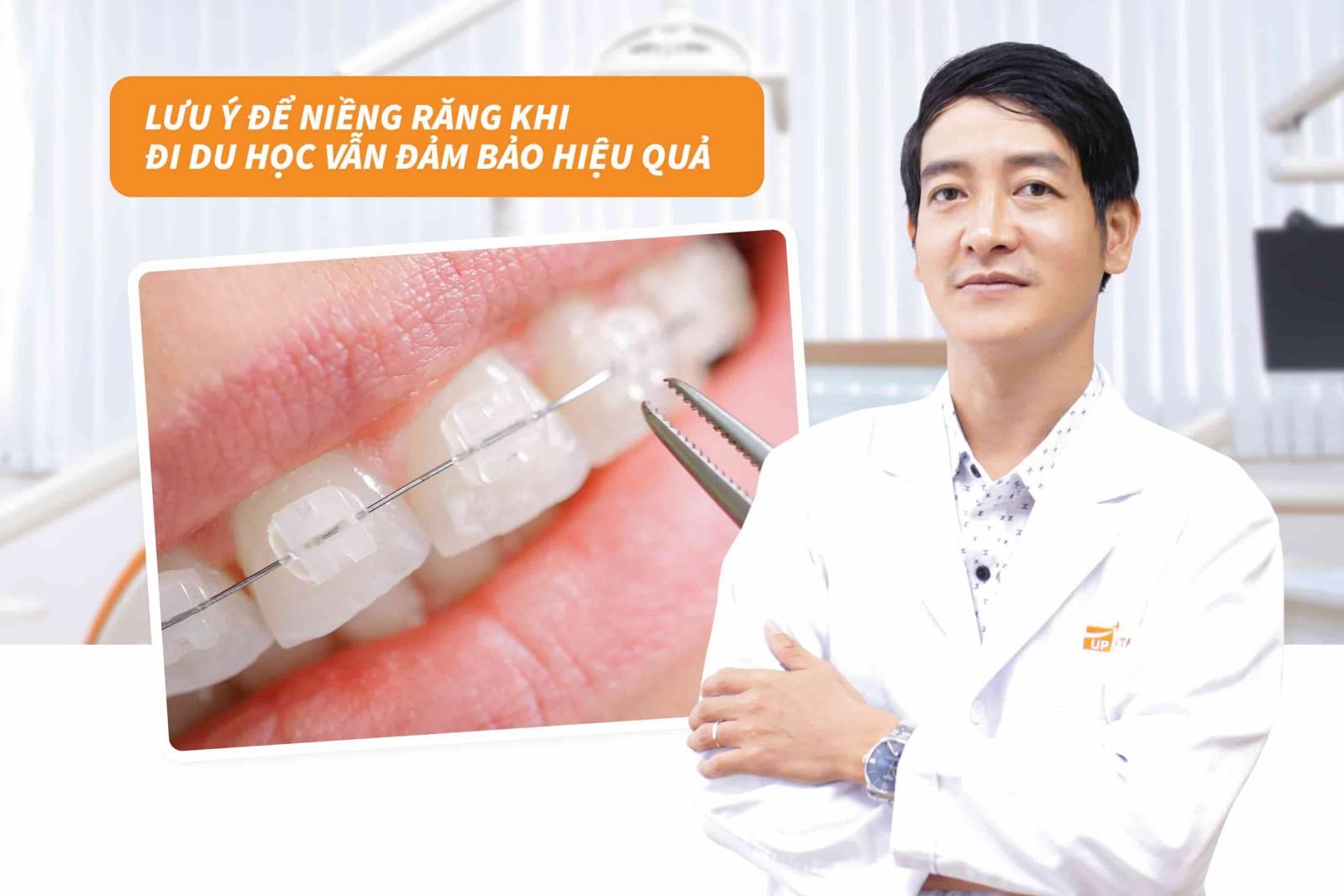 Lưu ý để niềng răng khi đi du học vẫn đảm bảo hiệu quả