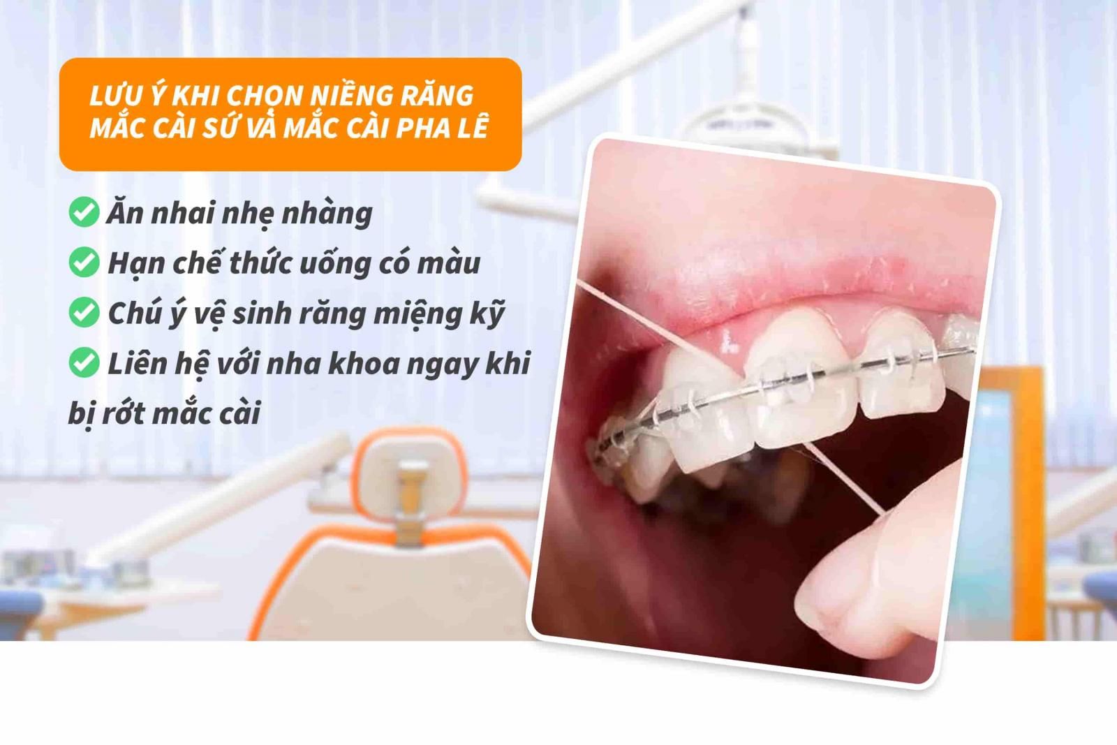 Lưu ý khi chọn niềng răng mắc cài sứ và mắc cài pha lê