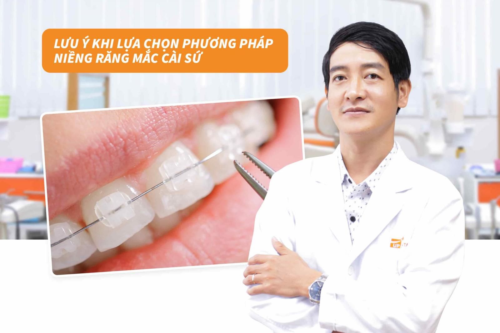 Lưu ý khi lựa chọn phương pháp niềng răng mắc cài sứ