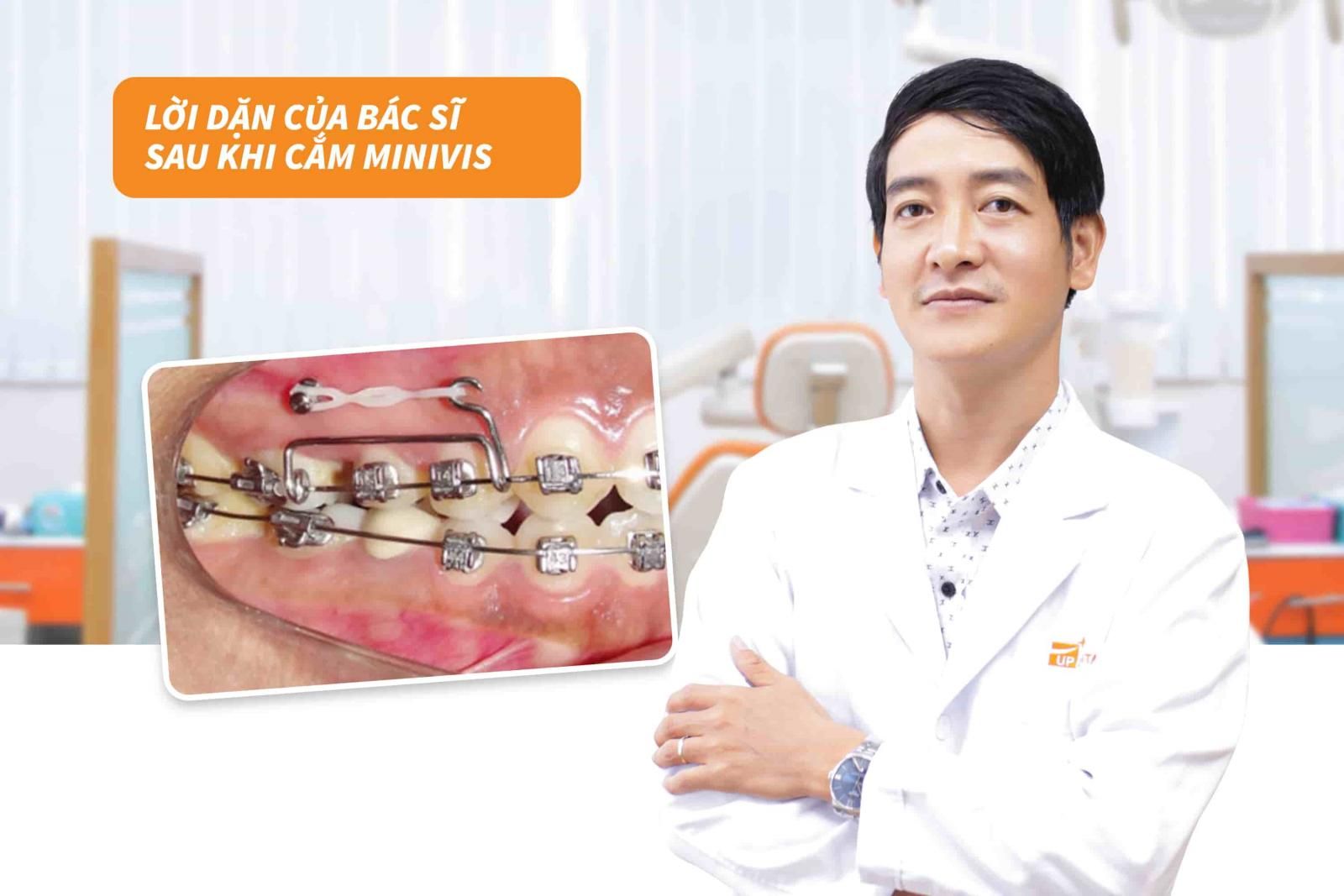 Kinh nghiệm niềng răng 12: Lưu ý sau khi cắm minvis