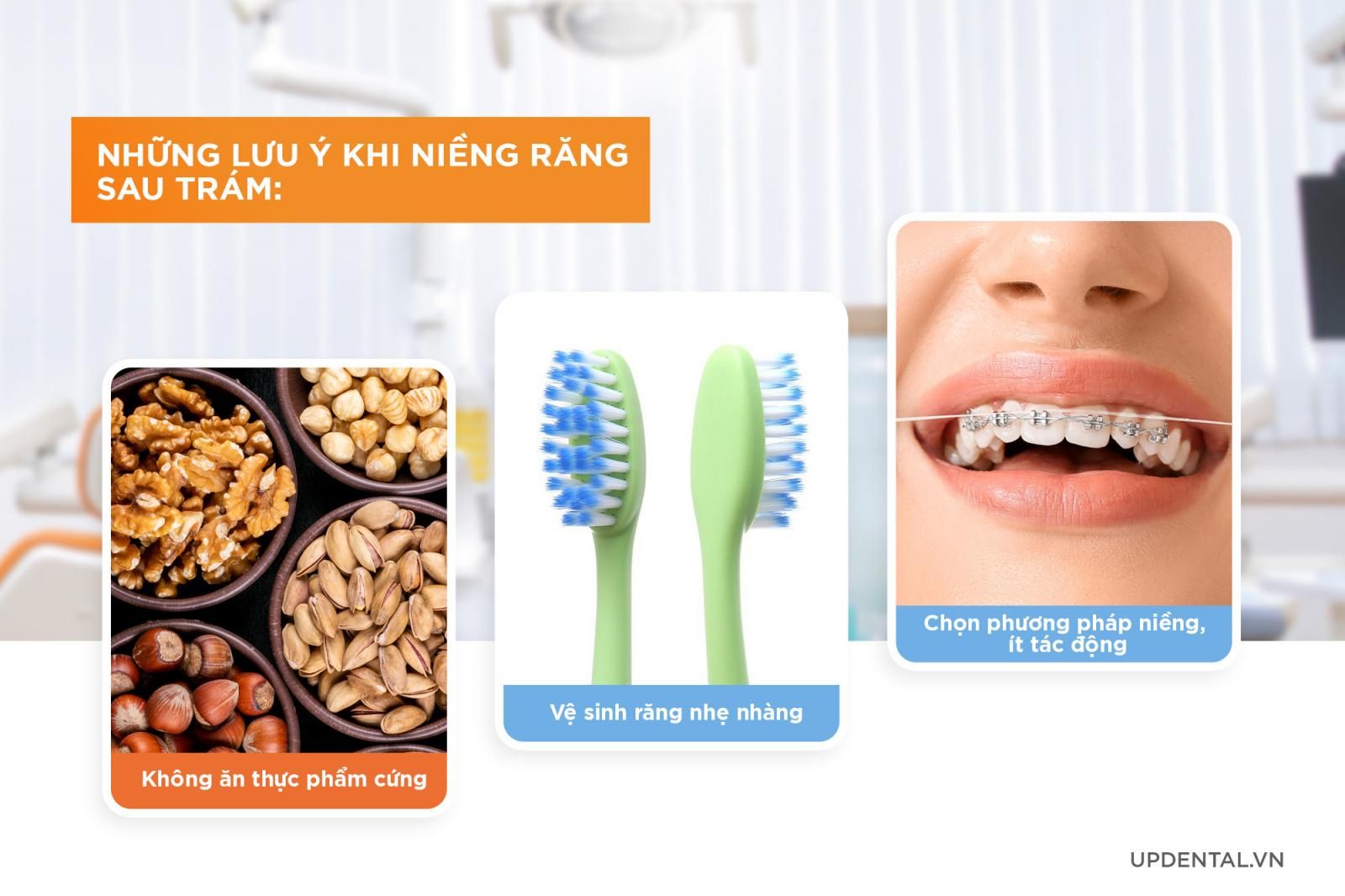 những lưu ý niềng răng sau trám răng