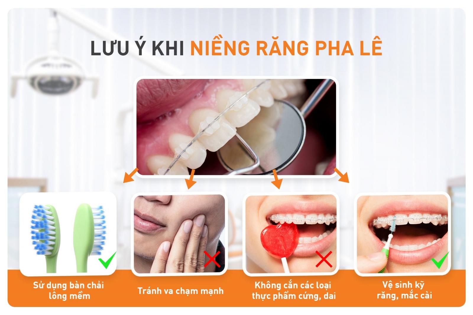 lưu ý niềng răng pha lê