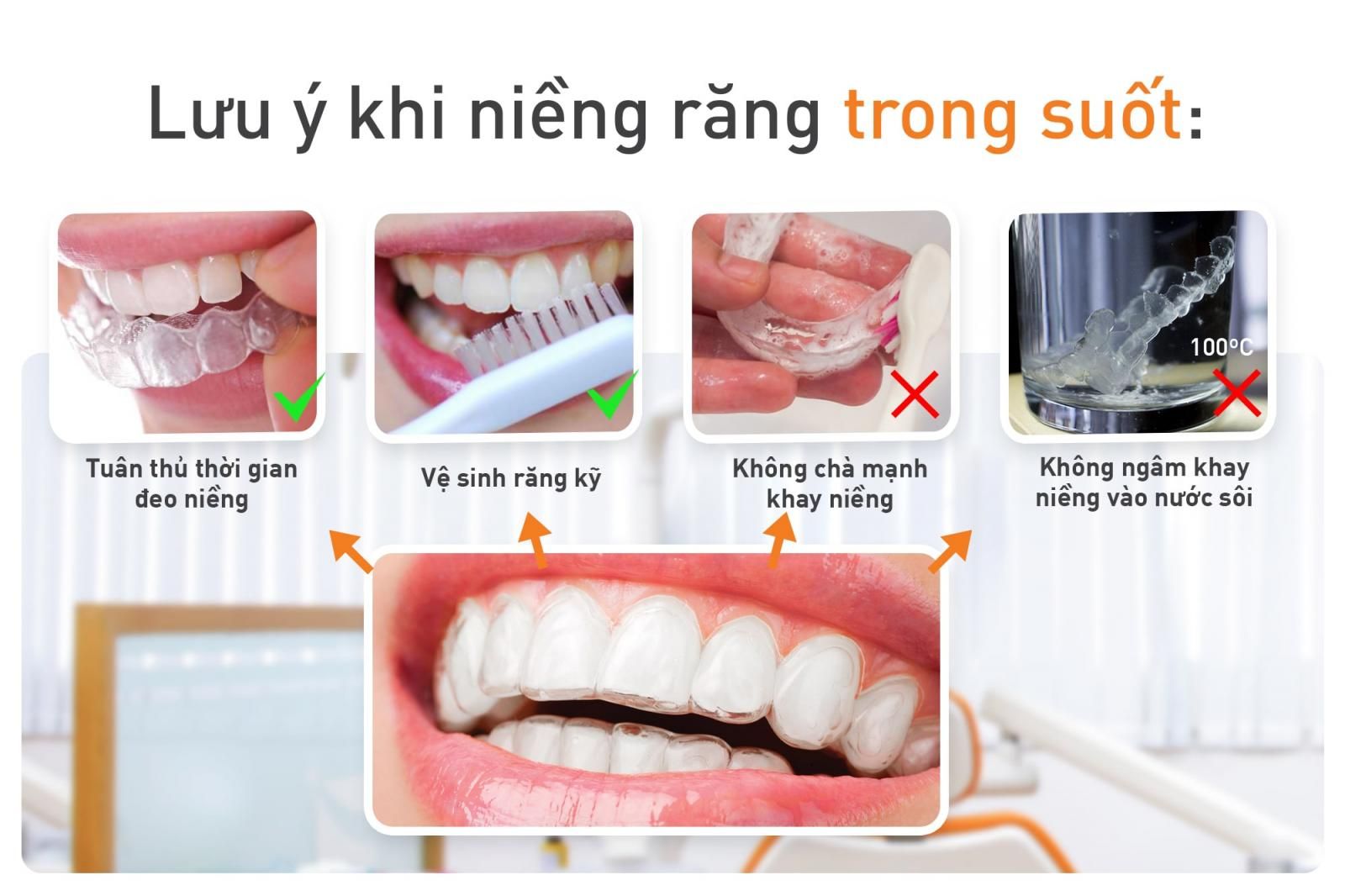 lưu ý niềng răng không mắc cài