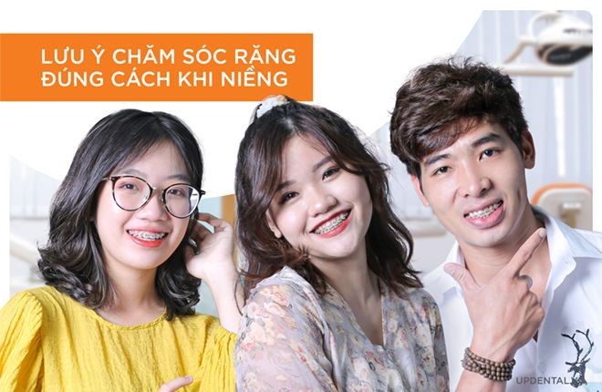 lưu ý chăm sóc răng đúng cách khi niềng