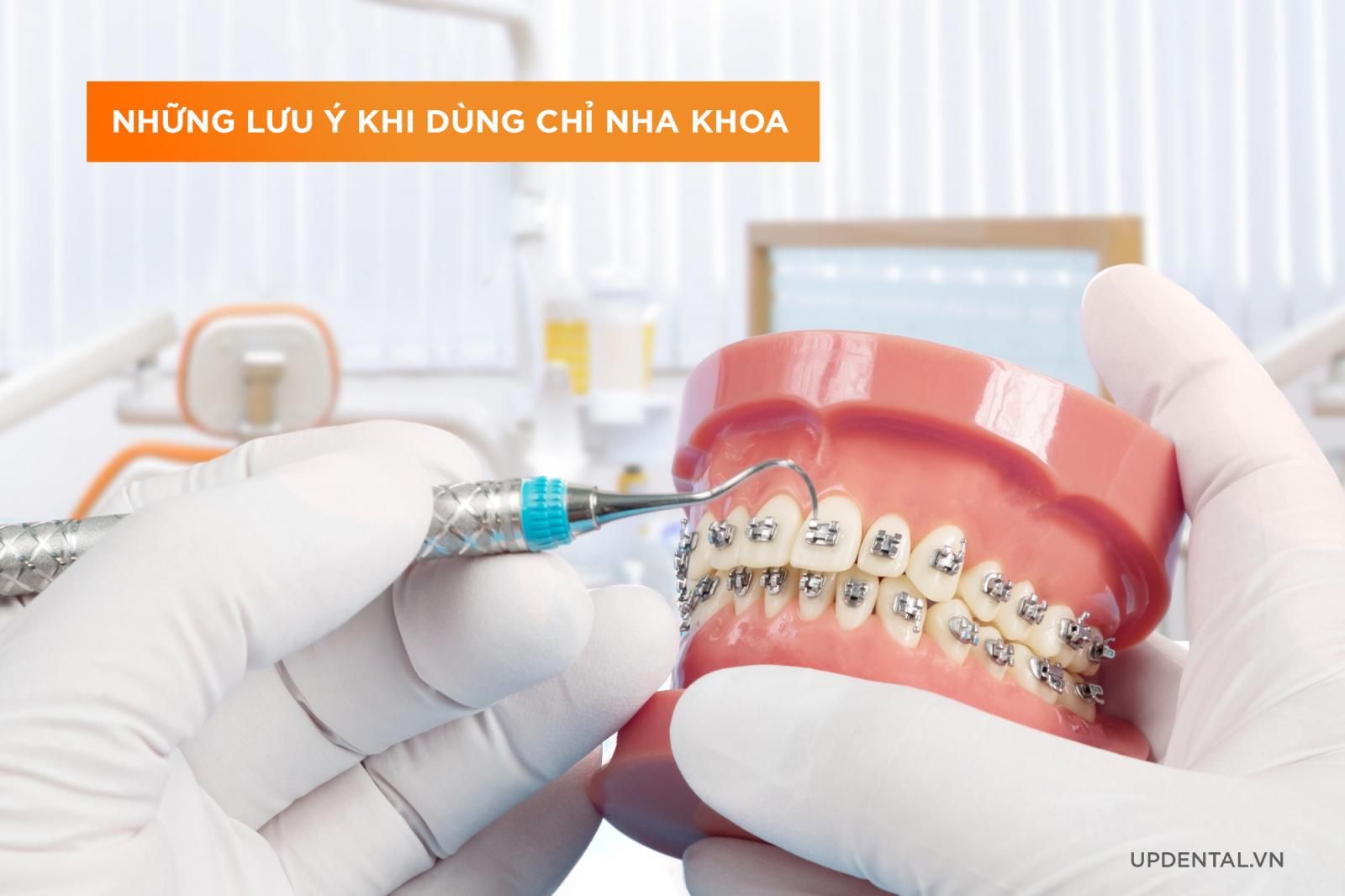 Lưu ý khi dùng chỉ nha khoa cho người niềng răng