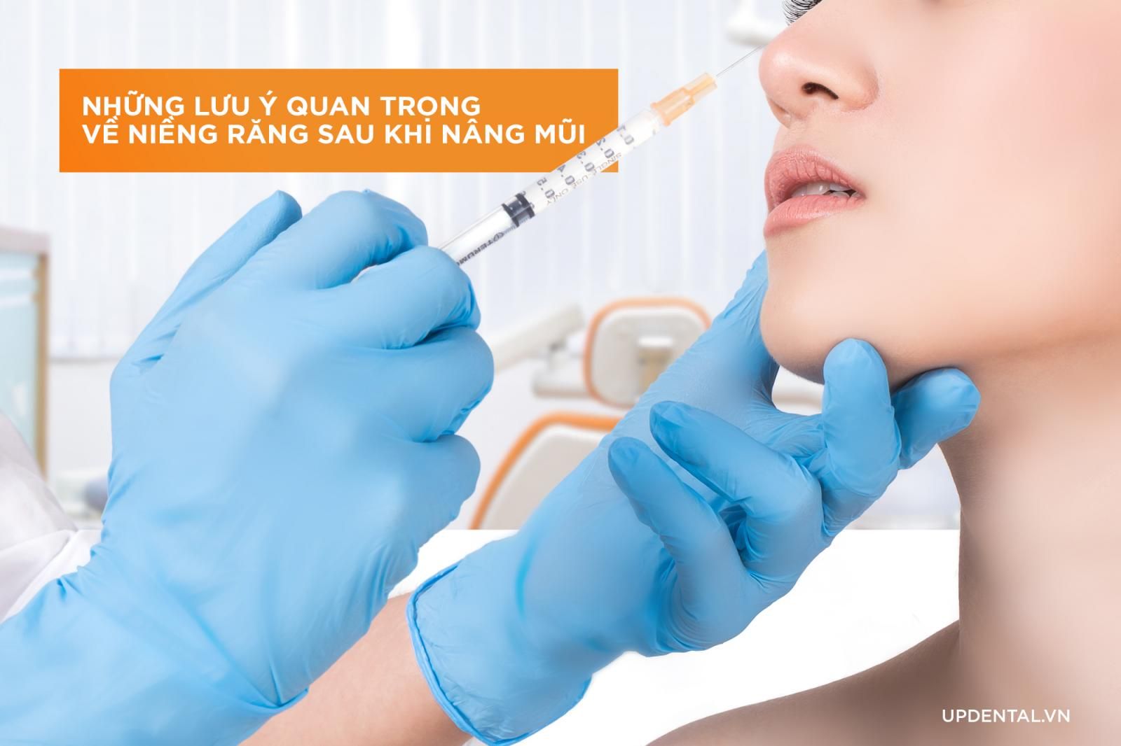 Lưu ý khi niềng răng nâng mũi