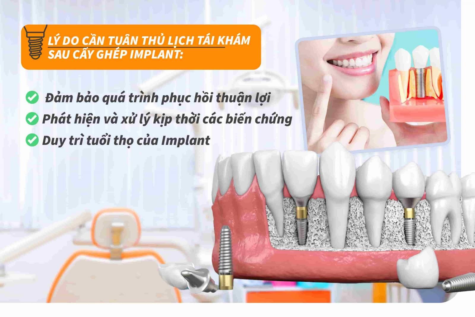 Vì sao cần tuân thủ lịch tái khám sau cấy ghép Implant?