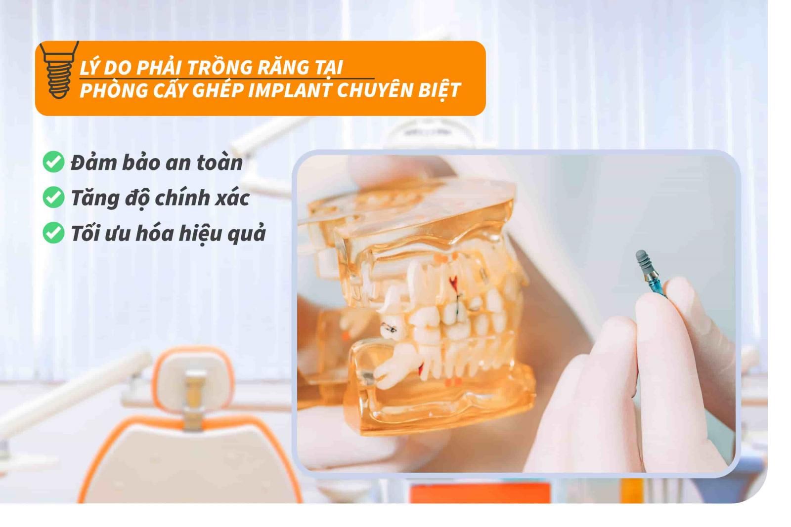 Lý do phải trồng răng tại phòng cấy ghép Implant chuyên biệt