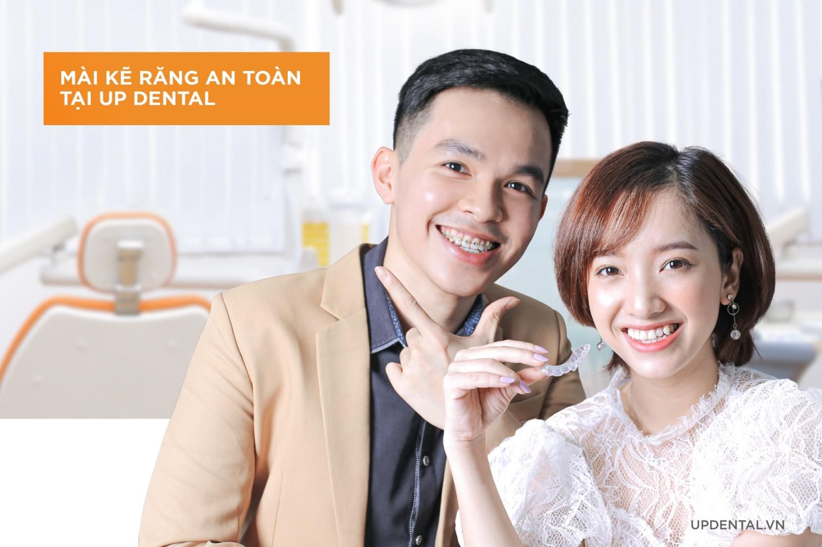 Mài kẽ răng an toàn tại Up Dental