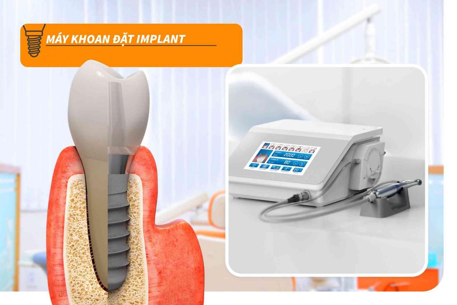 Máy khoan đặt Implant