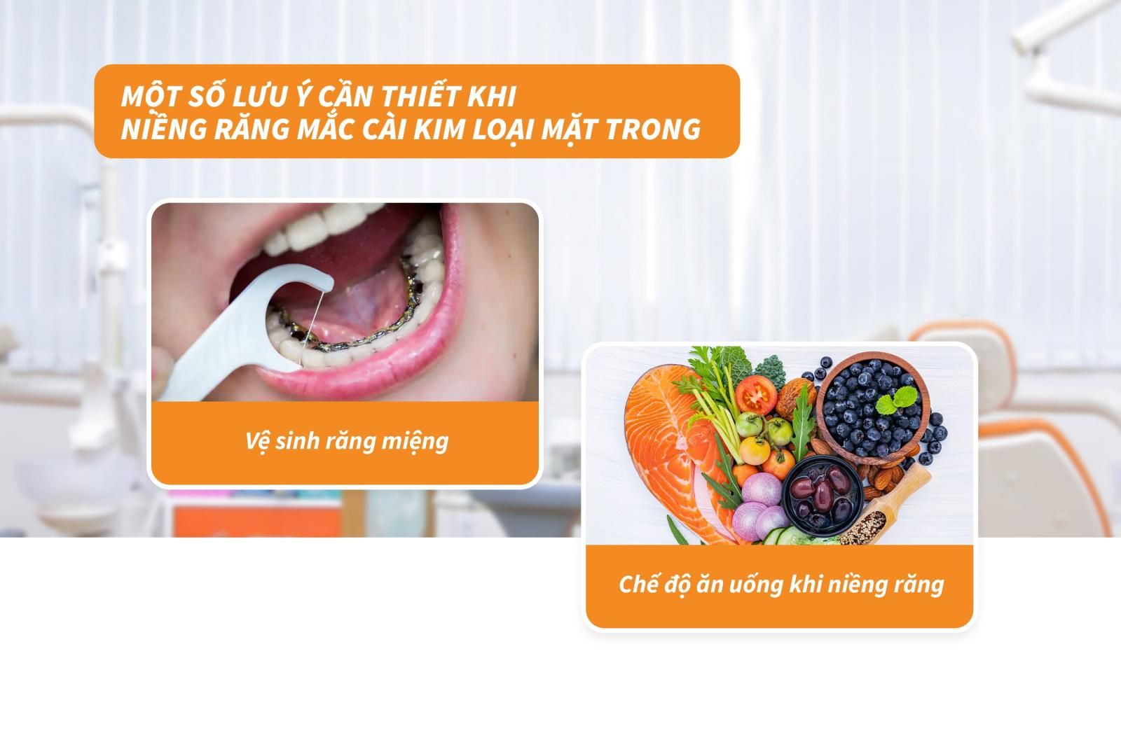 Một số lưu ý cần thiết khi niềng răng mắc cài kim loại mặt trong