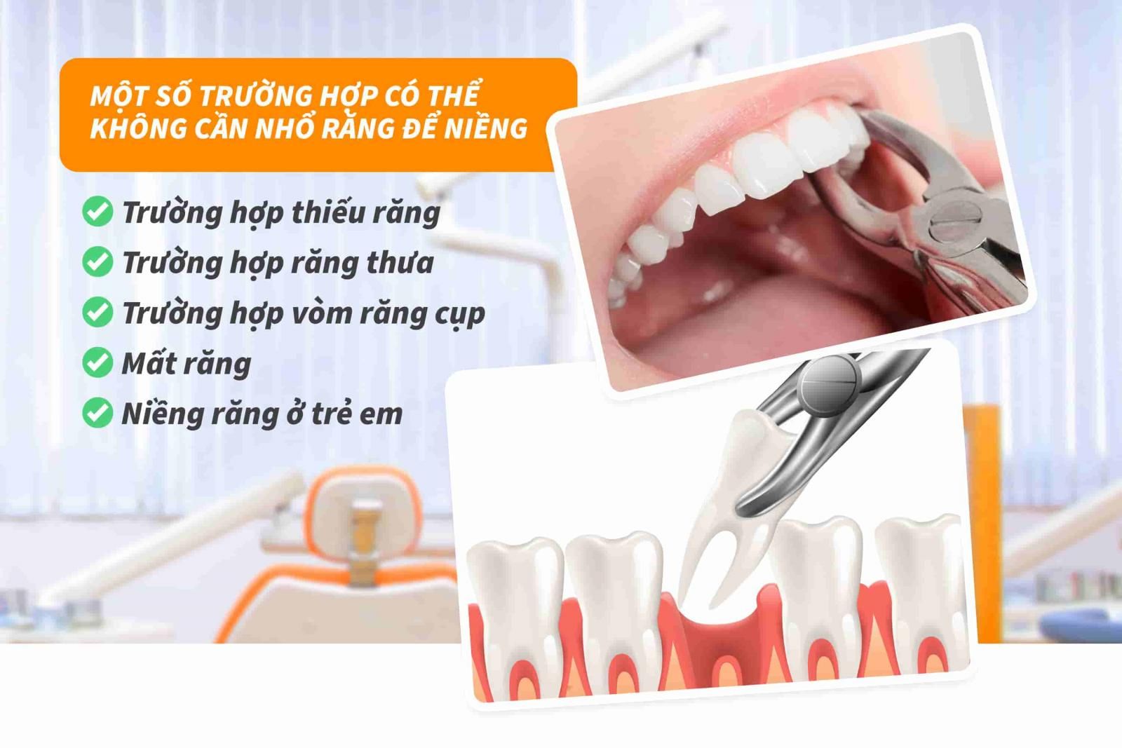 5 trường hợp niềng răng không cần nhổ răng