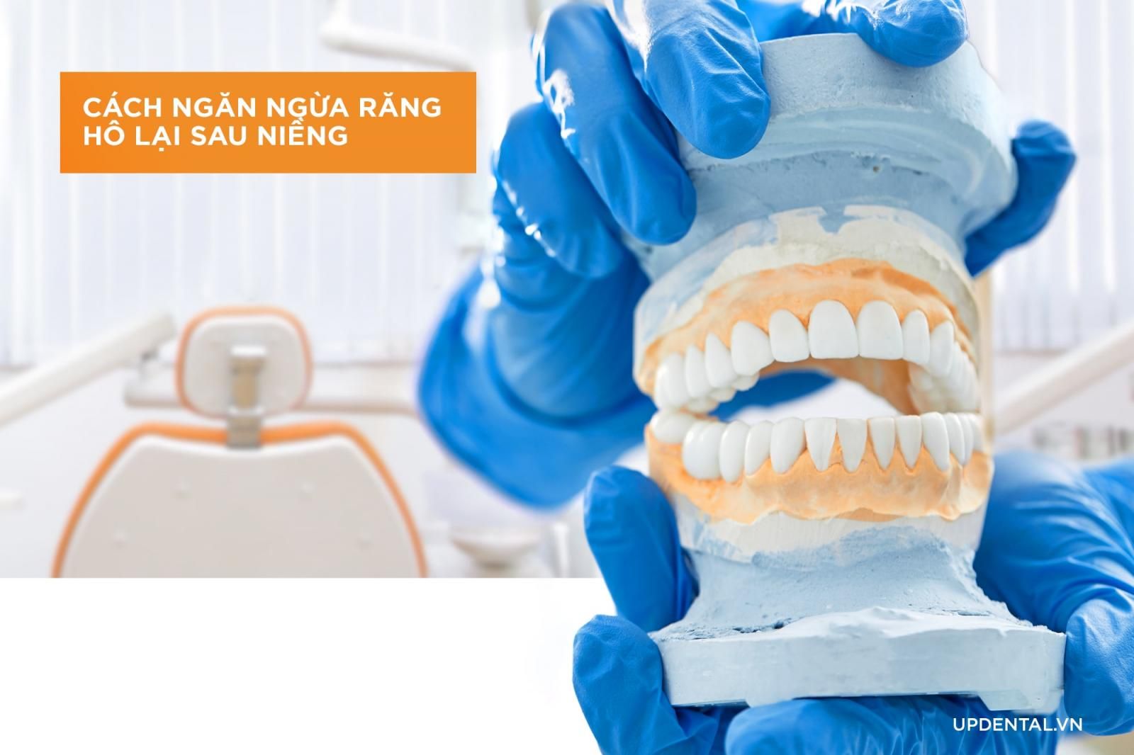 Cách ngăn ngừa răng hô lại sau niềng