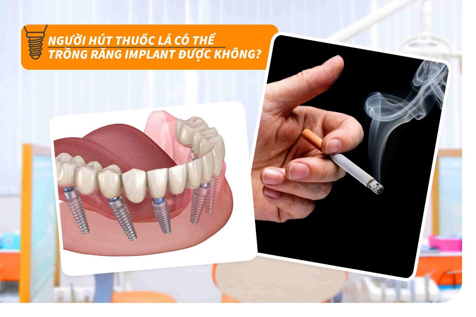 Người hút thuốc lá có thể trồng răng Implant được không?