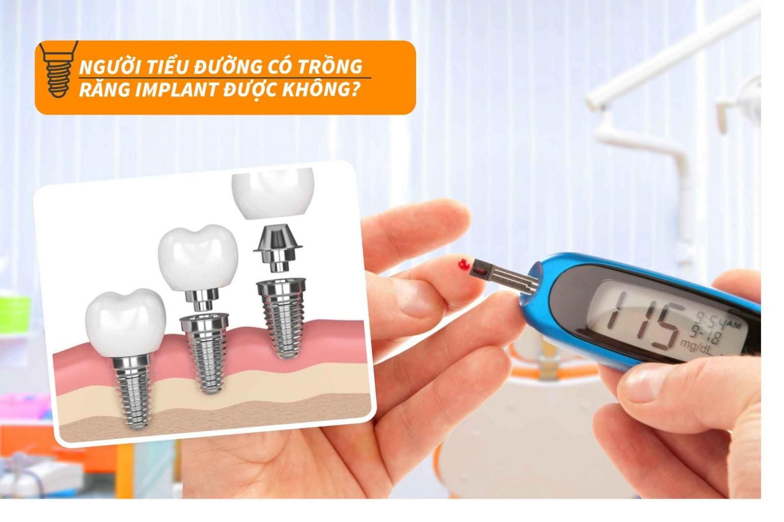 Người tiểu đường có trồng răng Implant được không?