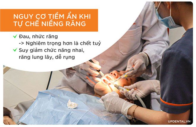 nguy cơ tiềm ẩn khi tự chế niềng răng