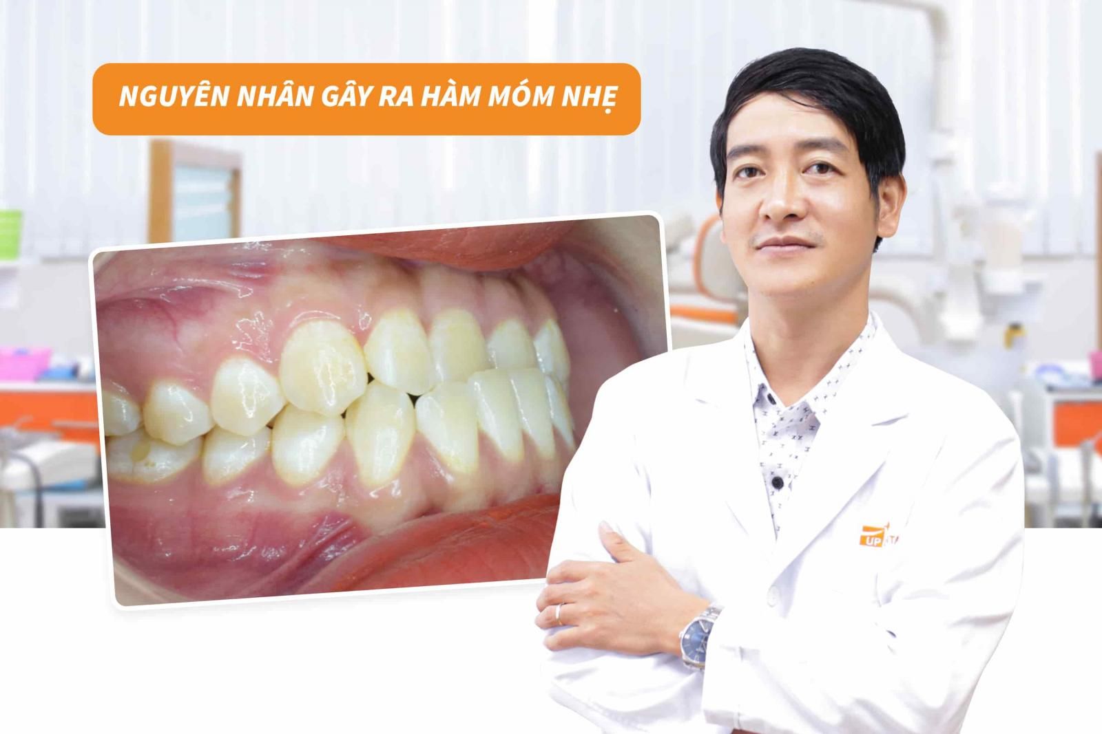 Nguyên nhân gây ra hàm móm nhẹ